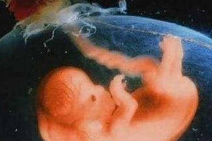 图片[1]-胎儿性别是在什么时候形成的?胎儿性别由男性决定-有孕帮
