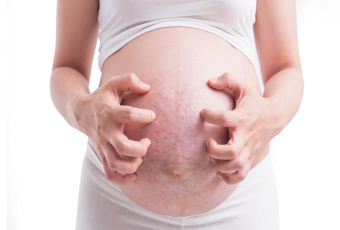 怀孕期间为什么会长妊娠纹?孕期怎么预防妊娠纹-有孕帮